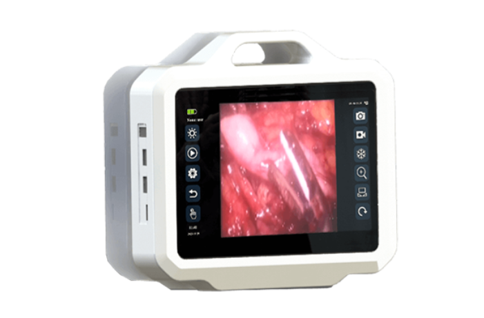 endotracheal intubation camera