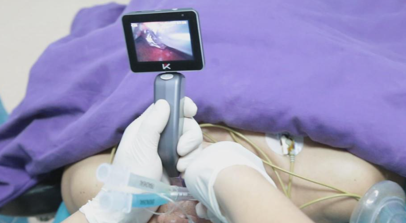 intubation scope