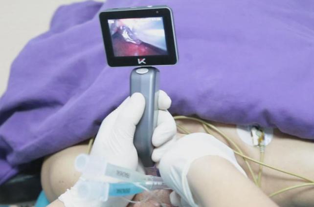 laryngoscope video