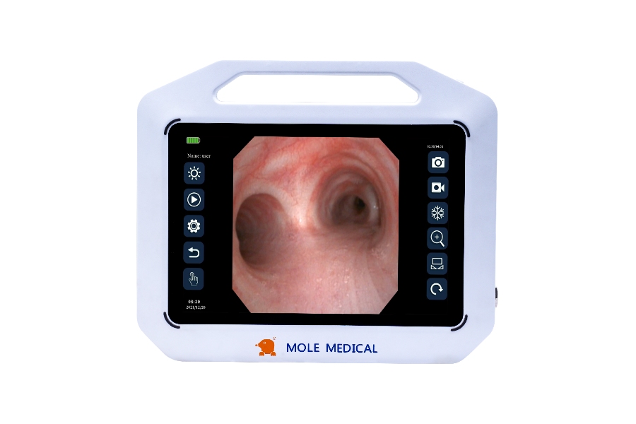 Medical Endoscope Display